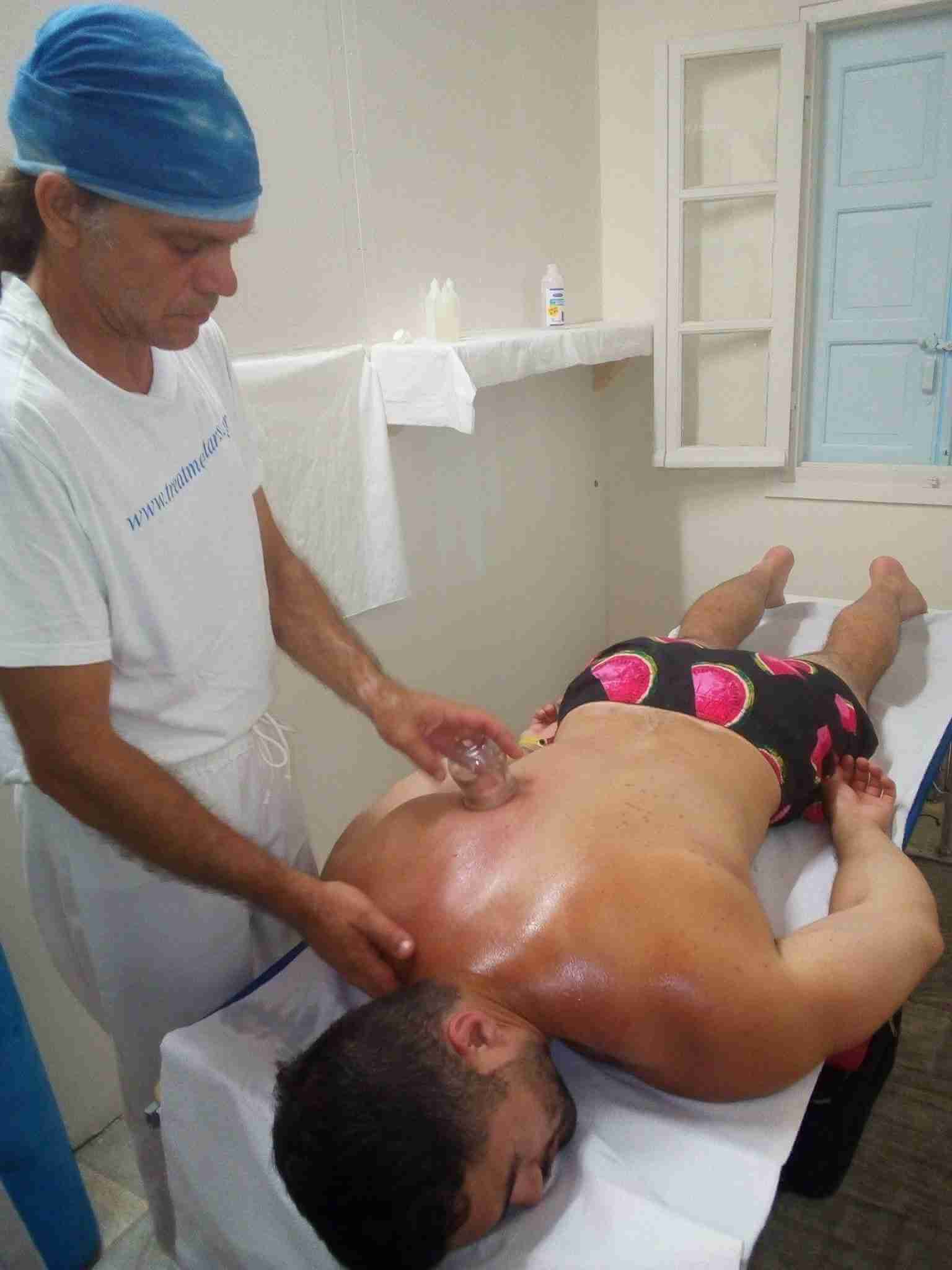 picture of a man getting a cupping glass therapy